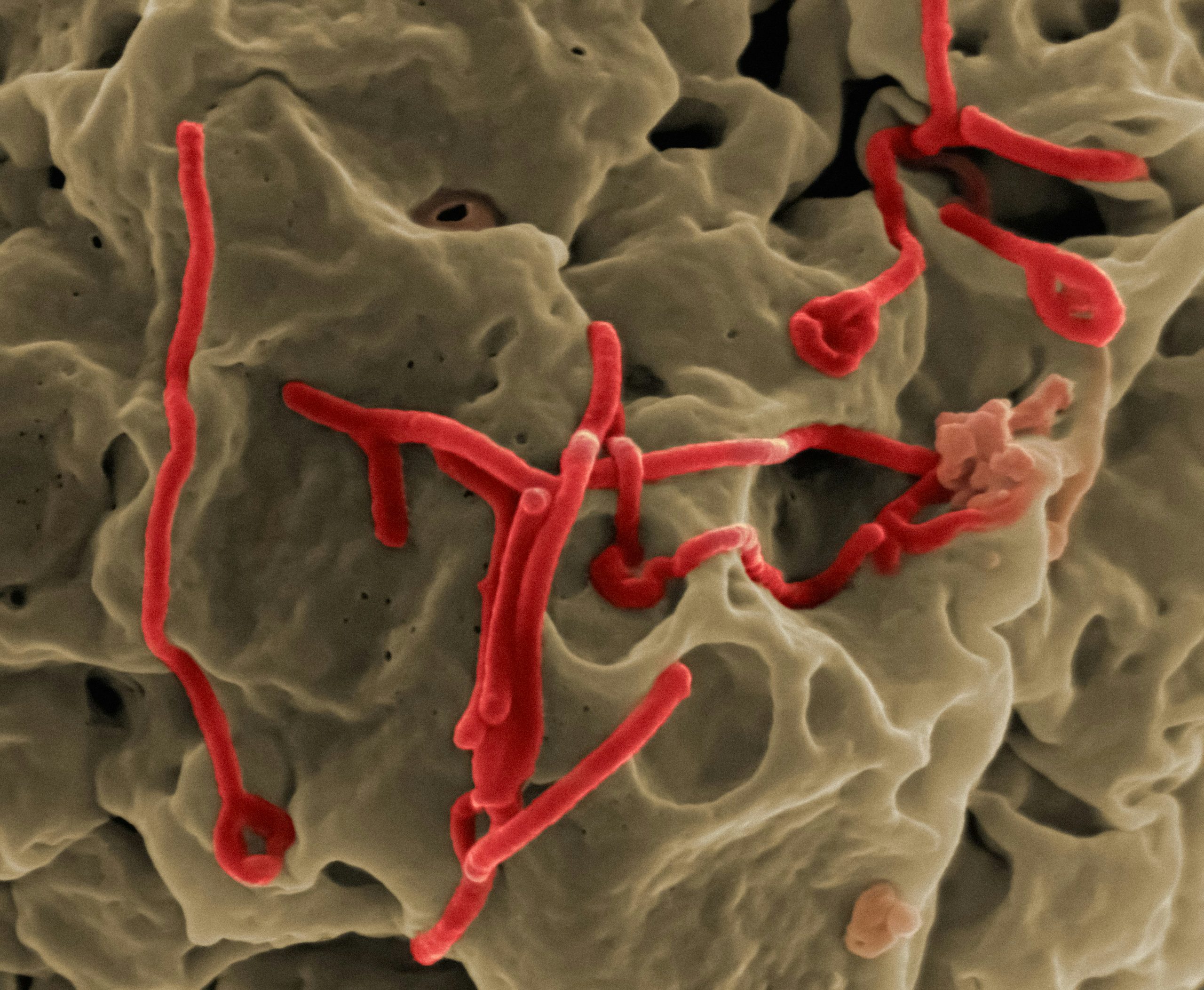 Breaking News: Kenya Confirms First-Ever Imported Case of Ebola Virus Disease